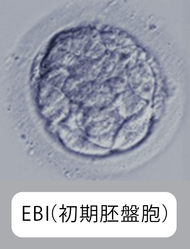 胚培養・移植 | ウィメンズクリニックふじみ野:不妊治療/体外受精