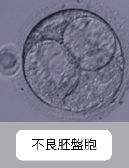 胚培養・移植 | ウィメンズクリニックふじみ野:不妊治療/体外受精
